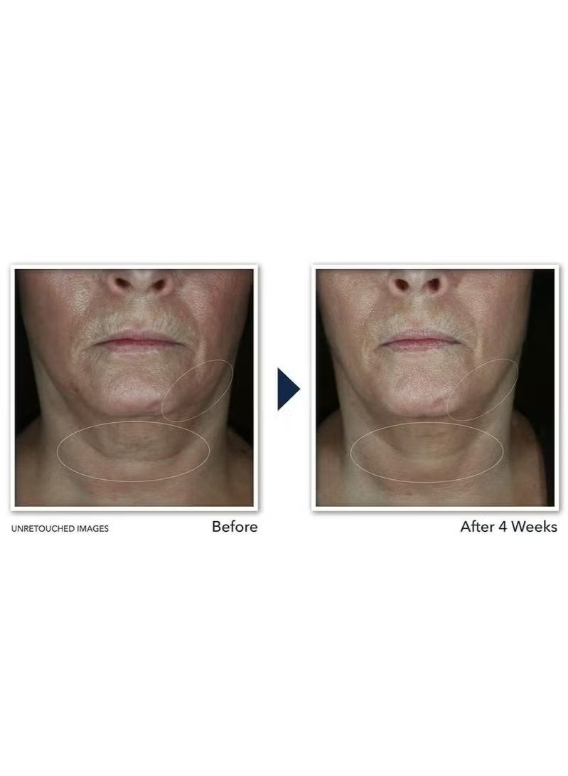 روك كريم شد الرقبة Derm Correxion مع حمض الهيالورونيك والريتينول المتقدم لشد الخطوط الأفقية في الرقبة بشكل مرئي، مرطب للوجه يعزز تجعيدات الوجه والرقبة والذقن، (1.7 أونصة) - Image 3